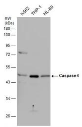Anti-Caspase 4 antibody used in Western Blot (WB). GTX113639