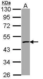 Anti-Caspase 4 antibody used in Western Blot (WB). GTX113639