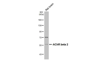 Anti-AChR beta 2 antibody [N1C1] used in Western Blot (WB). GTX113654