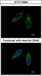 Anti-CYP2C8 antibody used in Immunocytochemistry/ Immunofluorescence (ICC/IF). GTX113666