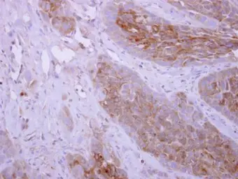 Anti-DPYD antibody [N1N2], N-term used in IHC (Paraffin sections) (IHC-P). GTX113672