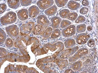 Anti-Cortactin antibody [N1C1] used in IHC (Paraffin sections) (IHC-P). GTX113680