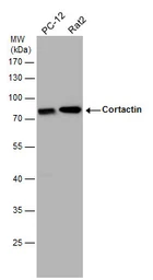Anti-Cortactin antibody [N1C1] used in Western Blot (WB). GTX113680