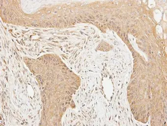 Anti-Cortactin antibody [N1C1] used in IHC (Paraffin sections) (IHC-P). GTX113680