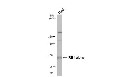 Anti-IRE1 alpha antibody [N1N2], N-term used in Western Blot (WB). GTX113682