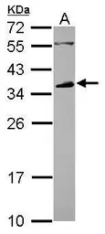 Anti-CD32B antibody [N2C3] used in Western Blot (WB). GTX113693