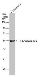 Anti-Fibrinogen beta antibody [C1C3] used in Western Blot (WB). GTX113694