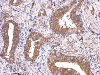Anti-VEGFD antibody used in IHC (Paraffin sections) (IHC-P). GTX113695