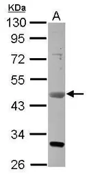Anti-VEGFD antibody used in Western Blot (WB). GTX113695