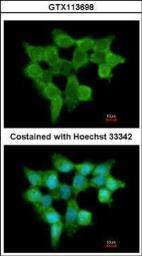 Anti-FMO3 antibody [C1C3] used in Immunocytochemistry/ Immunofluorescence (ICC/IF). GTX113698