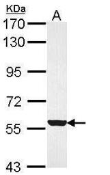 Anti-FMO3 antibody [C1C3] used in Western Blot (WB). GTX113698