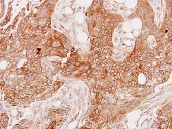 Anti-GSTA1 antibody used in IHC (Paraffin sections) (IHC-P). GTX113722