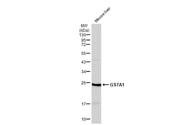 Anti-GSTA1 antibody used in Western Blot (WB). GTX113722