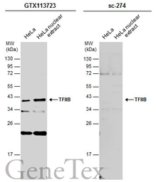 Anti-TFIIB antibody [N2C3] used in Western Blot (WB). GTX113723