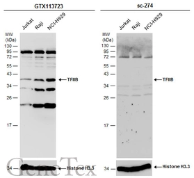 Anti-TFIIB antibody [N2C3] used in Western Blot (WB). GTX113723
