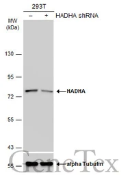 Anti-HADHA antibody [N2C1], Internal used in Western Blot (WB). GTX113727