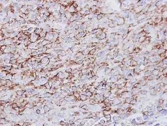Anti-HLA-DRA antibody [N2C3] used in IHC (Paraffin sections) (IHC-P). GTX113732