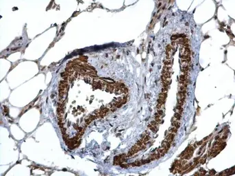 Anti-HUS1 antibody used in IHC (Paraffin sections) (IHC-P). GTX113745