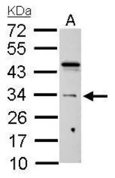 Anti-HUS1 antibody used in Western Blot (WB). GTX113745