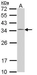 Anti-HUS1 antibody used in Western Blot (WB). GTX113745