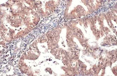 Anti-HYAL1 antibody used in IHC (Paraffin sections) (IHC-P). GTX113747