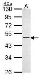 Anti-HYAL1 antibody used in Western Blot (WB). GTX113747