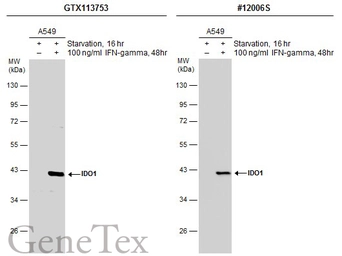 Anti-IDO1 antibody used in Western Blot (WB). GTX113753