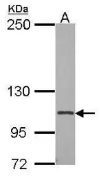 Anti-CD41 antibody [N2C1], Internal used in Western Blot (WB). GTX113758