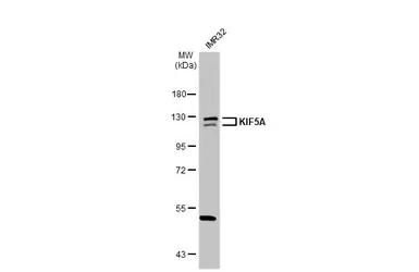 Anti-KIF5A antibody [N3C2], Internal used in Western Blot (WB). GTX113761