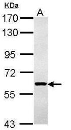 Anti-Cytokeratin 4 antibody used in Western Blot (WB). GTX113764