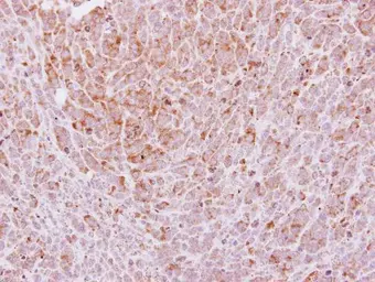 Anti-Laminin gamma 2 antibody [N3C1], Internal used in IHC (Paraffin sections) (IHC-P). GTX113765