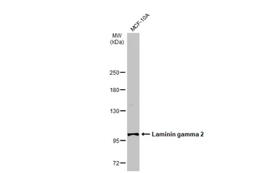 Anti-Laminin gamma 2 antibody [N3C1], Internal used in Western Blot (WB). GTX113765