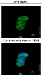 Anti-Monoamine Oxidase B antibody [N1N3] used in Immunocytochemistry/ Immunofluorescence (ICC/IF). GTX113771