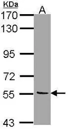 Anti-Monoamine Oxidase B antibody [N1N3] used in Western Blot (WB). GTX113771