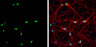 Anti-Muscleblind-like 1 antibody [N1C2] used in Immunocytochemistry/ Immunofluorescence (ICC/IF). GTX113773