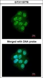 Anti-MLK1 antibody [N2N3] used in Immunocytochemistry/ Immunofluorescence (ICC/IF). GTX113778