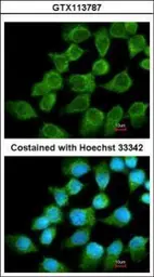 Anti-NDUFS1 antibody used in Immunocytochemistry/ Immunofluorescence (ICC/IF). GTX113787