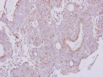 Anti-NDUFS1 antibody used in IHC (Paraffin sections) (IHC-P). GTX113787
