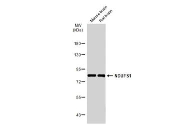Anti-NDUFS1 antibody used in Western Blot (WB). GTX113787