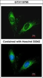 Anti-PAI3 antibody used in Immunocytochemistry/ Immunofluorescence (ICC/IF). GTX113795