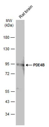 Anti-PDE4B antibody [C2C3], C-term used in Western Blot (WB). GTX113798