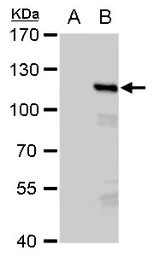 Anti-PMS2 antibody [N1N3] used in Western Blot (WB). GTX113804