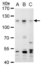 Anti-PMS2 antibody [N1N3] used in Western Blot (WB). GTX113804