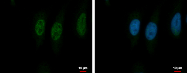 Anti-PSMA5 antibody used in Immunocytochemistry/ Immunofluorescence (ICC/IF). GTX113812