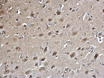 Anti-PSMA5 antibody used in IHC (Paraffin sections) (IHC-P). GTX113812