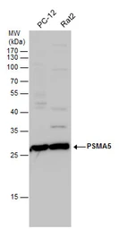 Anti-PSMA5 antibody used in Western Blot (WB). GTX113812
