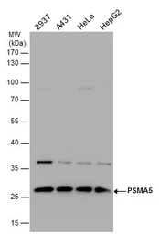 Anti-PSMA5 antibody used in Western Blot (WB). GTX113812