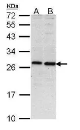 Anti-PSMD10 antibody [N1C3] used in Western Blot (WB). GTX113813