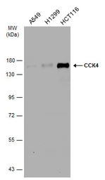 Anti-CCK4 antibody [N1N2], N-term used in Western Blot (WB). GTX113816