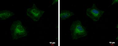 Anti-CCK4 antibody [N1N2], N-term used in Immunocytochemistry/ Immunofluorescence (ICC/IF). GTX113816